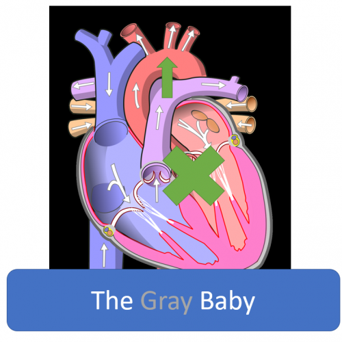 Gray Baby